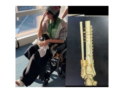 재활 중인 선수 출전 결정에 팬들 반응 뜨거운 듯